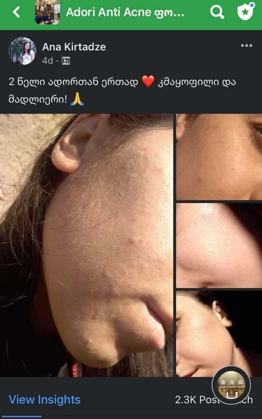 პაციენტის დასრულებული მკურნალობის შედეგი